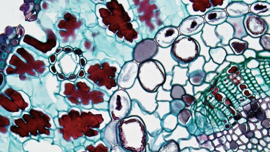 What the MIT Keto Cancer Study Actually Found (and What It Doesn't Mean)